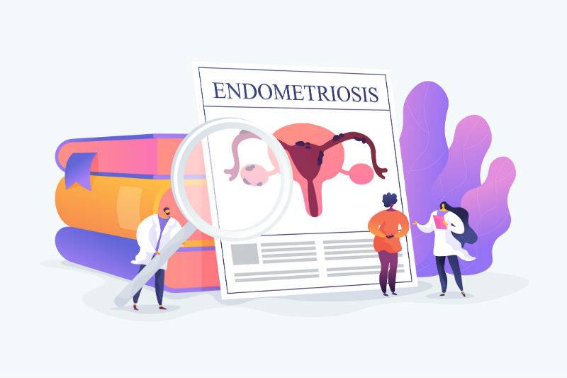 what are the 10 things you need to know about endometriosis