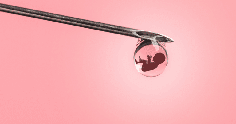 IVF Lite for Women with Endometriosis