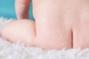 help a child who farts a lot