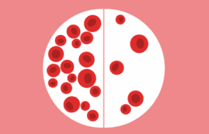 natural medicines for iron deficiency anaemia