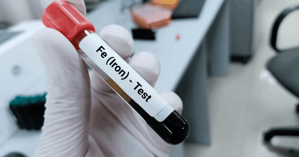 how to know if you are iron deficient