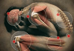 naturopathic approach to pain