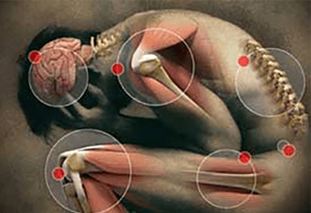 naturopathic approach to pain