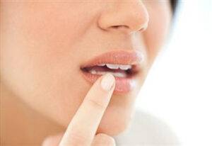 how to stop a cold sore to come up
