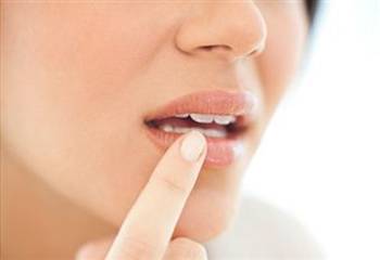 how to stop a cold sore to come up