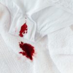 Blood-stained underwear on a white towel, illustrating endometriosis and heavy periods.