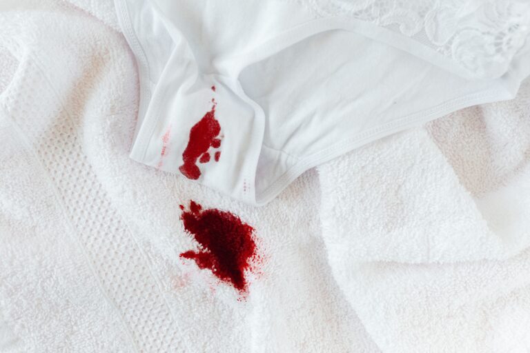 Blood-stained underwear on a white towel, illustrating endometriosis and heavy periods.